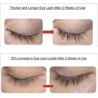 Lash Growth Treatment - Eyeliner - LAshX® PRO/Line Package