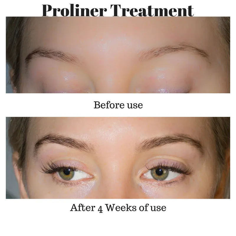 Lash Growth Treatment - Eyeliner - LAshX® PRO/Line Package