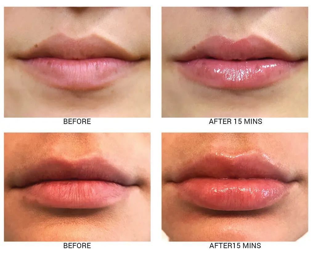 Lip Plumping Treatment with SPF 30